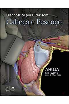 Diagnostico por Ultrassom: Cabeça e Pescoço - Anil Anil T. Ahuja