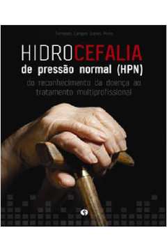 Hidrocefalia de Pressão Normal (hpn) - Fernando Campos Gomes Pinto
