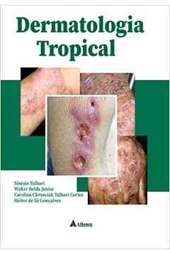 Dermatologia Tropical (novo) - Sinésio Talhari / Walter Belda Junior