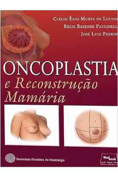Oncoplastia e Reconstrução Mamária ( Novo- Lacrado) -- Clécio ênio Murta de Lucena