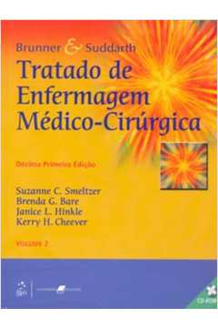 Brunner & Suddarth: Tratado de Enfermagem Médico-cirúrgica 2 Vol-10ªed - Suzanne C Smeltzer; Brenda G Bare