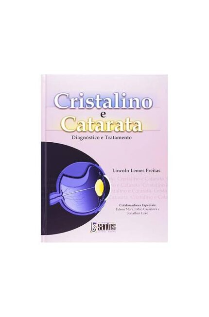 Cristalino e Catarata: Diagnóstico e Tratamento- L. L Freitas