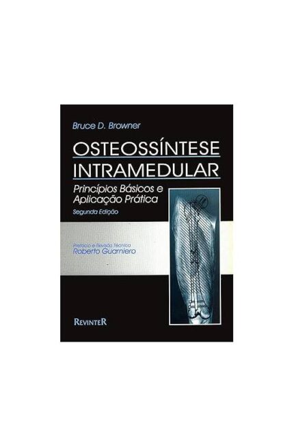 Osteossíntese Intramedular 2ª Edição-