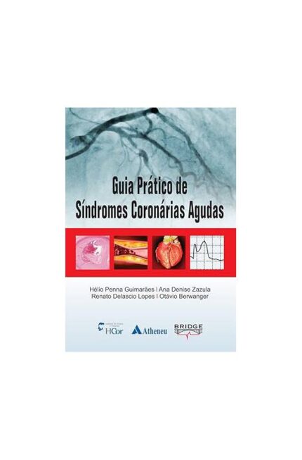 Guia Pratico de Síndromes Coronárias Agudas- Hélio Penna Guimarães